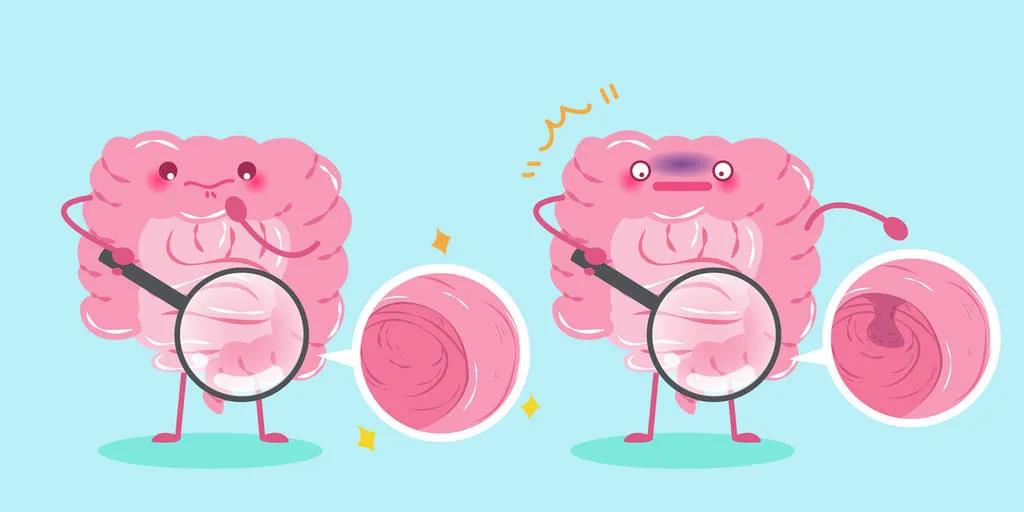 因为忽视身体出现的这些变化，他们最后被确诊结肠癌