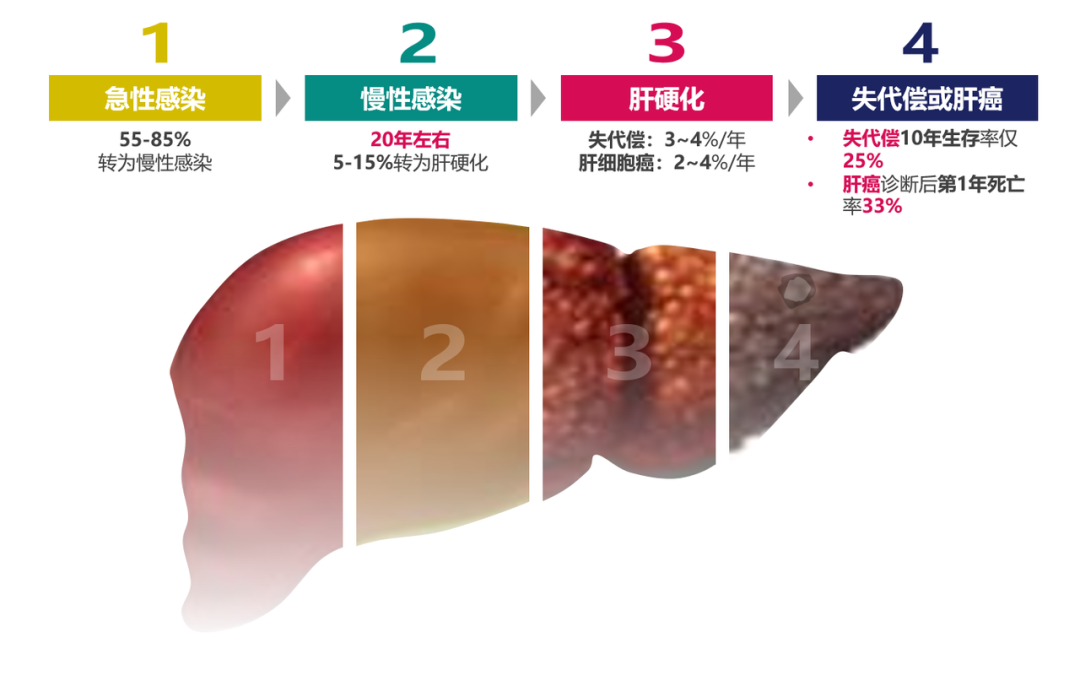 悄悄变成肝硬化、肝癌，很多人感染了却不知道