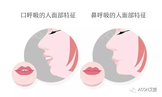 过敏性鼻炎会让孩子变傻?!家长该如何应对 过敏性鼻炎会让孩子变傻?!家长该如何应对